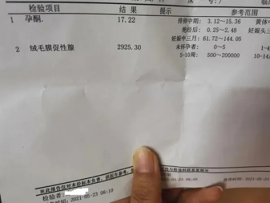 (孕酮多高有利于着床)孕酮水平高低说明着床了，孕酮值多少正常？